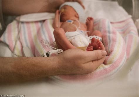 Pictures Of Premature Babies Born At 31 Weeks Baby Viewer