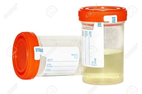 URINE COLLECTION BOTTLE - Sukitha Pharmacy & Clinic (Pvt) Ltd