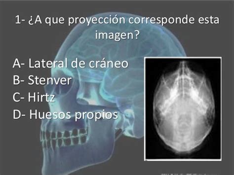 Proyecciones radiológicas del cráneo Craneo Imagenologia Ciencias