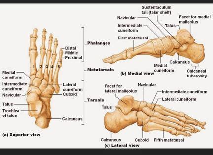 Metatarsus Adductus - Physiopedia