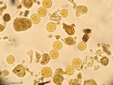 Cistos De Entamoeba Coli O Que é BRAINCP