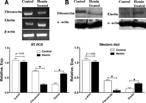 A : RT-PCR showing higher levels of elastin gene expression and lower ...