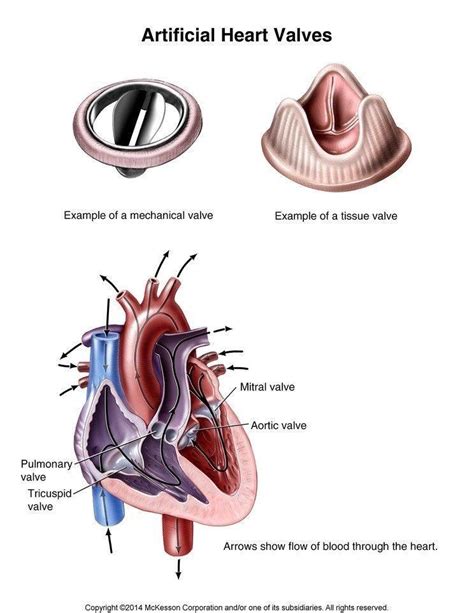 artificial heart valve