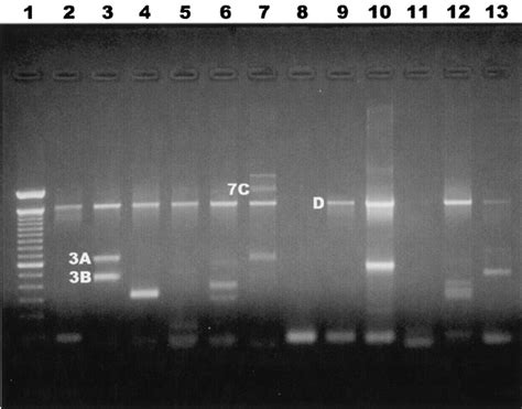 Pcr Products Ampli Fi Ed From Primary Cultures Using Universal 16s Rrna Download Scientific