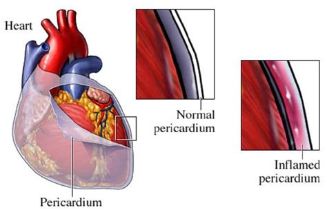 Pathophysiological Process And Clinical Presentation Correct Diagnosis