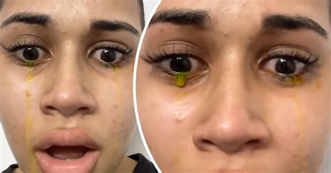 A Woman Shares A Video Of Her Crying Yellow Heres Why It Happens