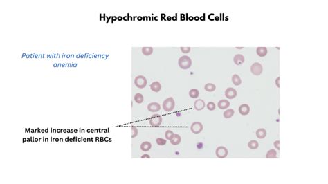 Red Cell Staining (Color) • The Blood Project