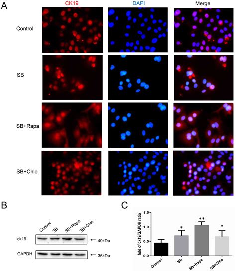 Autophagy Regulates Proliferation And Biliary Differentiation Of