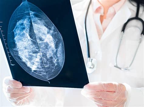 La mamografía o mastografía: imagen que detecta el cáncer de seno