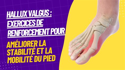 Hallux Valgus Comment soulager la douleur et éviter l aggravation