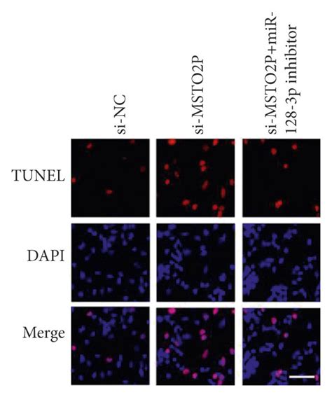 MiR 128 3p Regulated MSTO2P Knockdown Promoted Coptisine Sensitivity Of