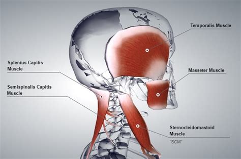 Remedial Massage For Headache And Migraine