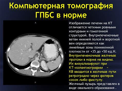 Лучевое исследование гепатопанкреатобилиарной системы и селезёнки ...