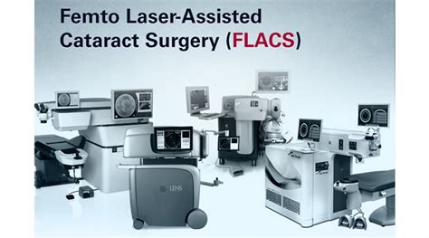 Cataract Xpress Cataractnews Femtosecond Laser Assisted Cataract Surgery