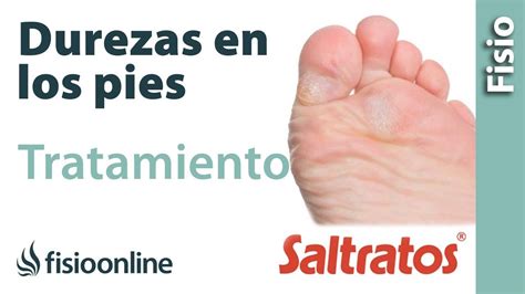 Tratamiento Y Consejos Para Los Callos Y Durezas Del Pie Fisioonline