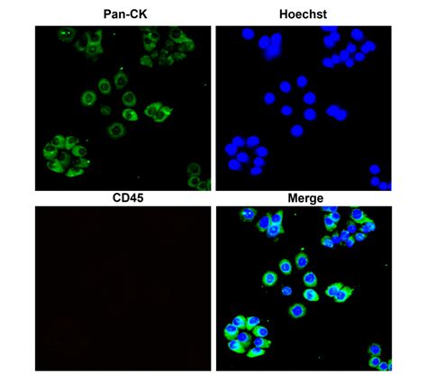 Cytoskeletal Marker Antibody Panel Irap Ireal Biotechnology Inc