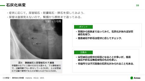 腹部単純x線腹部レントゲン どうやって使いますか？ Antaa Slide