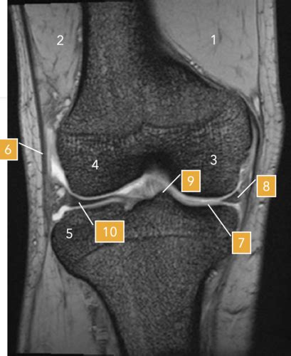 Lower Extremity 5 Labelling Review Flashcards Quizlet