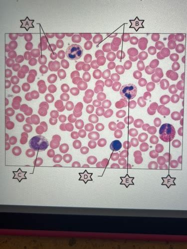 Blood Flashcards Quizlet