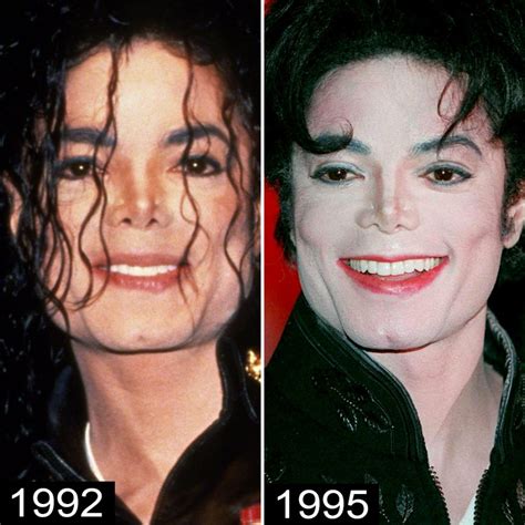 Michael Jacksons Plastic Surgery — See His Transformation