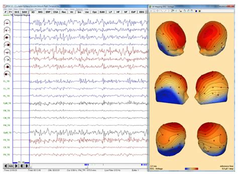 A matemática e física por trás dos sinais biológicos gerados pelo EEG