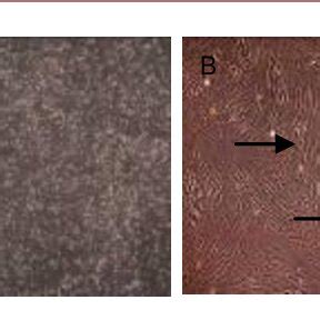 Morphology Of Primary Bone Marrow Mesenchymal Stem Cells A And Bone