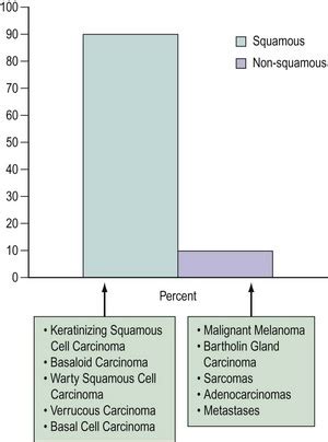 Malignant Disease Of The Vulva And Vagina Obgyn Key