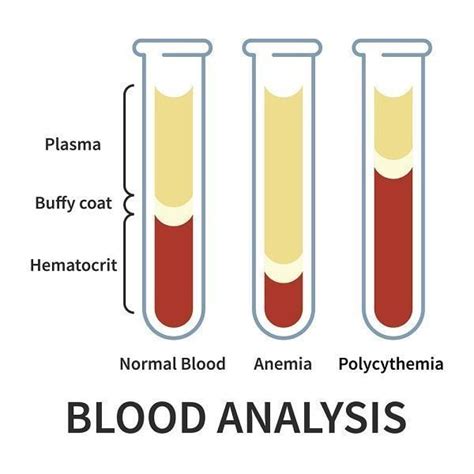 Hemoglobin Part Hematocrit Hct Packed Cell Volume PCV Atelier