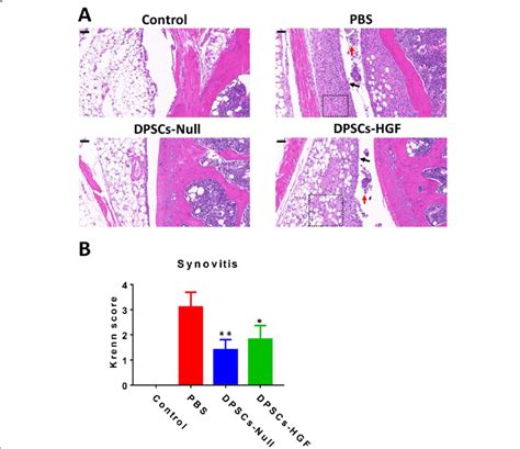 Synovitis Evaluation In CIA Mice After Different Treatments A Examples