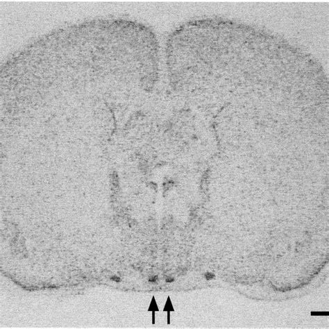 Film Autoradiograph Generated From A Coronal Section Of Rat Brain