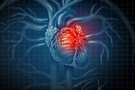 Myocardite Ce Quil Faut Savoir Sur Les Causes De Cette Pathologie