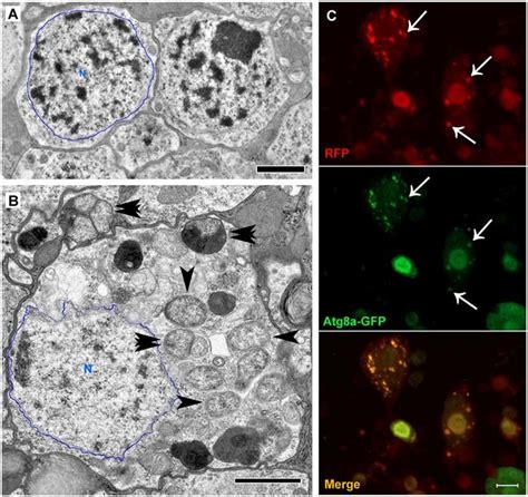 Ab 1 42 Induces An Accumulation Of Large Autophagic Vesicles A