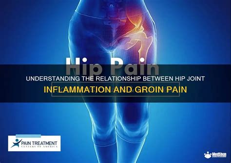 Understanding The Relationship Between Hip Joint Inflammation And Groin