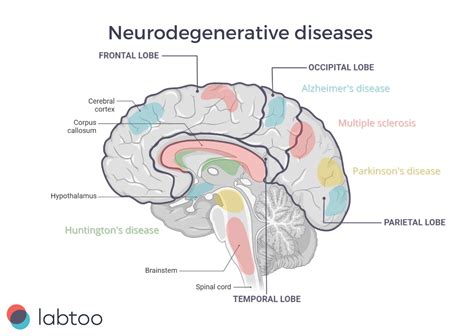 Neurodegenerative disorders: Research and Therapies