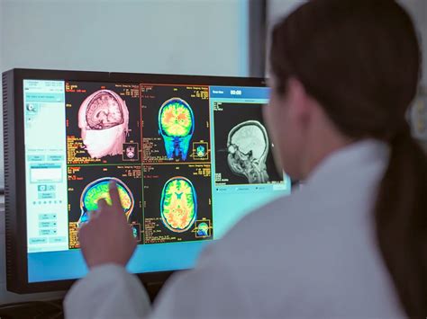 Tratamientos Contra El Alzheimer Cuáles Son Los últimos Avances De La Ciencia Infobae