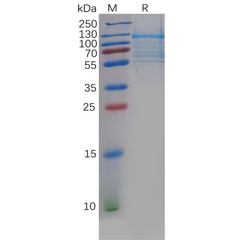 Human DLL3 Protein hFc Tag 专注肿瘤免疫