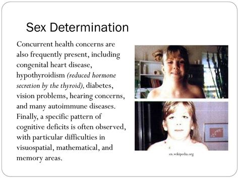 Ppt Blueprint Of Life Topic 12 Sex Linked Genes Powerpoint