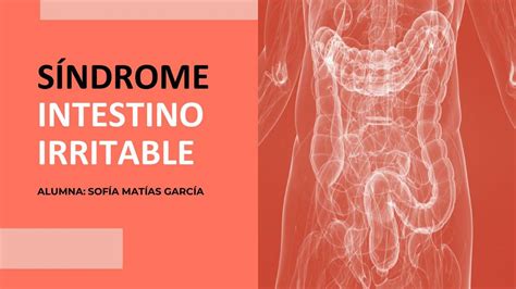 Síndrome Intestino Irritable Sofia Matias Garcia uDocz