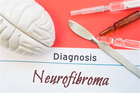 Neurofibromatosis Awareness: What You Need to Know - Facty Health