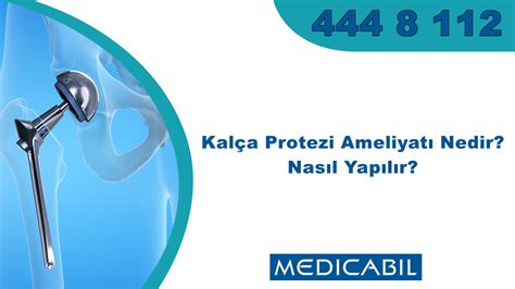 Blog Kal A Protezi Ameliyat Kal A Artroplastisi Nedir Nas L Yap L R