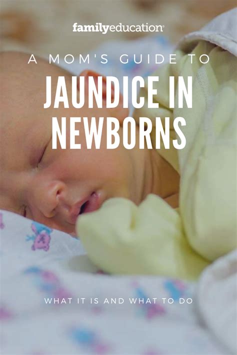 Natural Ways To Treat Jaundice In Newborn Babies