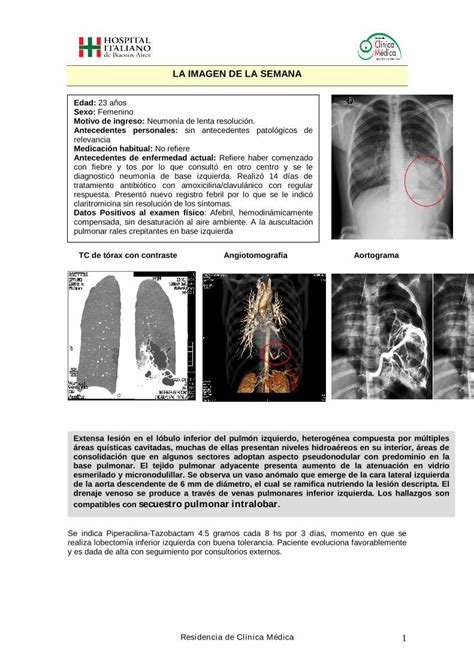 PDF La Imagen De La Semana III Hospitalitaliano Org Ar Absceso