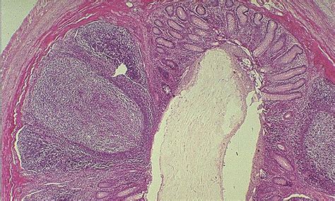 Appendix histology Diagram | Quizlet