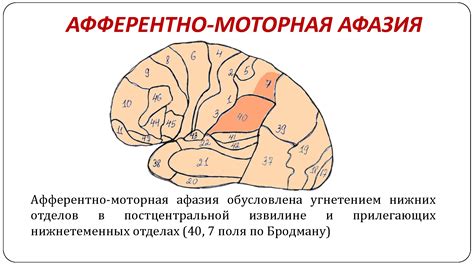Афферентная моторная афазия. Частный логопед,Харьков