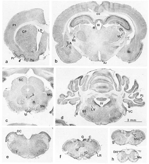 Structure of dorsal cochlear nucleus | Semantic Scholar