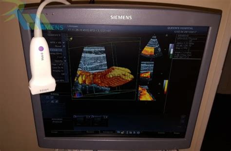 Siemens Vfx13 5 Linear 3d 2d Robin Medical Ltd