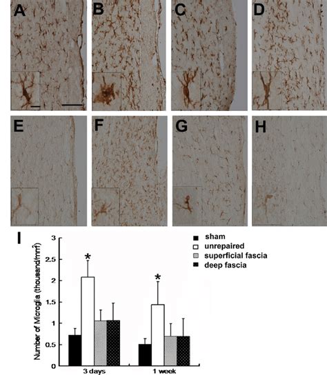 Activation Of Microglial Cells In The Spinal Cord Following Dural Tear