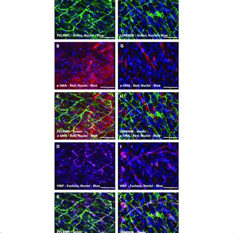 | Expression pattern of various endothelial cell markers in CCCs ...