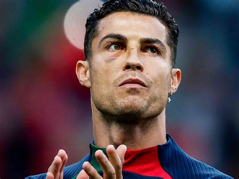 Tampil Dengan Mata Lebam Ini Nilai Cristiano Ronaldo Saat Portugal