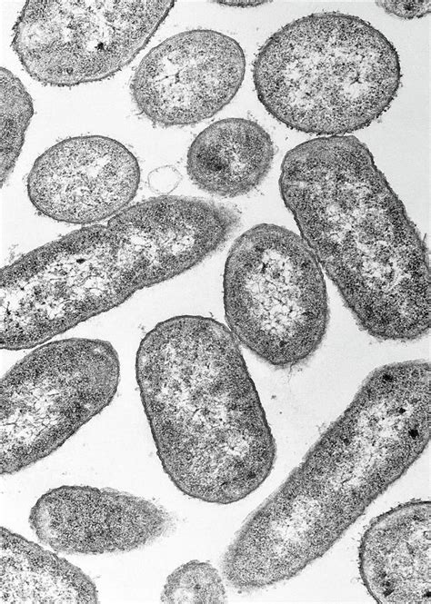 Tem Of E Coli Bacteria By A Dowsett Public Health Englandscience